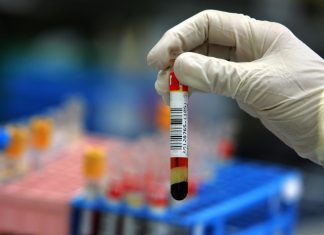 Coronavirus, via libera ai test rapidi presso le nostre sedi