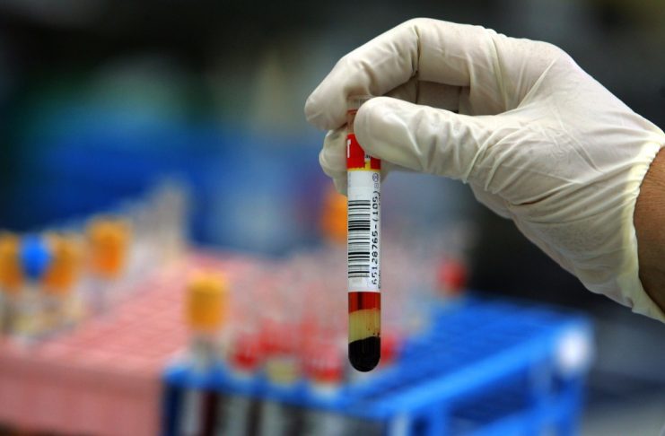 Coronavirus, via libera ai test rapidi presso le nostre sedi