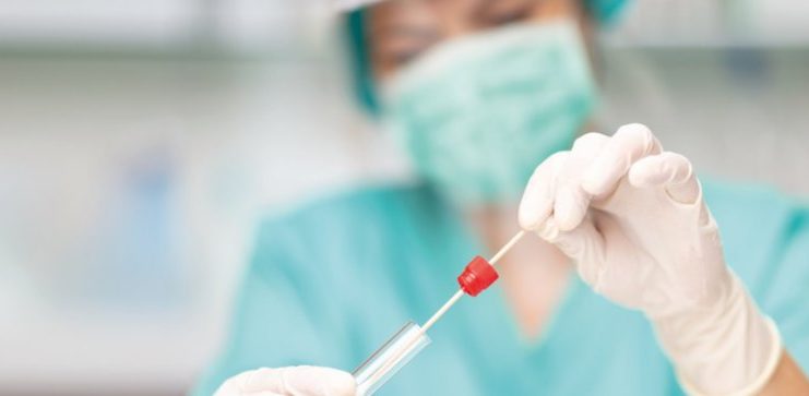 Tamponi rapidi e test sierologici. Le nostre scelte per una diagnosi accurata da Covid-19